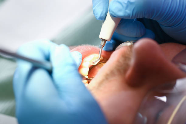 Best Pediatric Emergency Dentist in Hazleton, PA