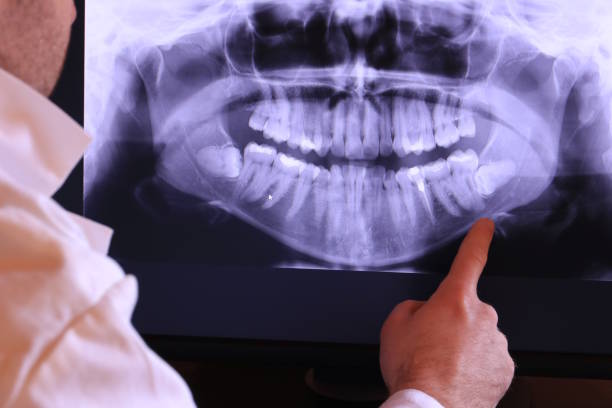 Best After-Hours Emergency Dentist in Hazleton, PA